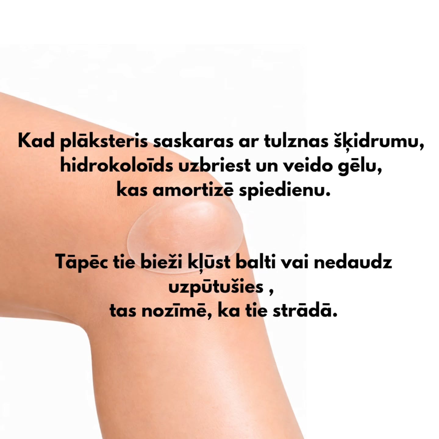 Hidrokoloīda plāksteri – maza medicīnas tehnoloģija, kas palīdz gan pumpām, gan tulznām.